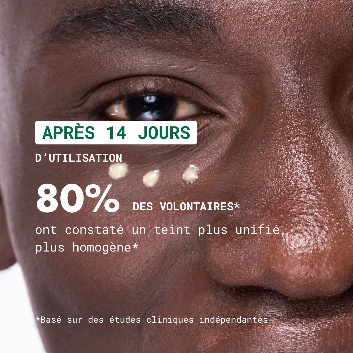Gesicht mit Serum-Auftrag. Text: Nach 14 Tagen, 80% der Teilnehmer stellten einen gleichmäßigeren Teint fest.