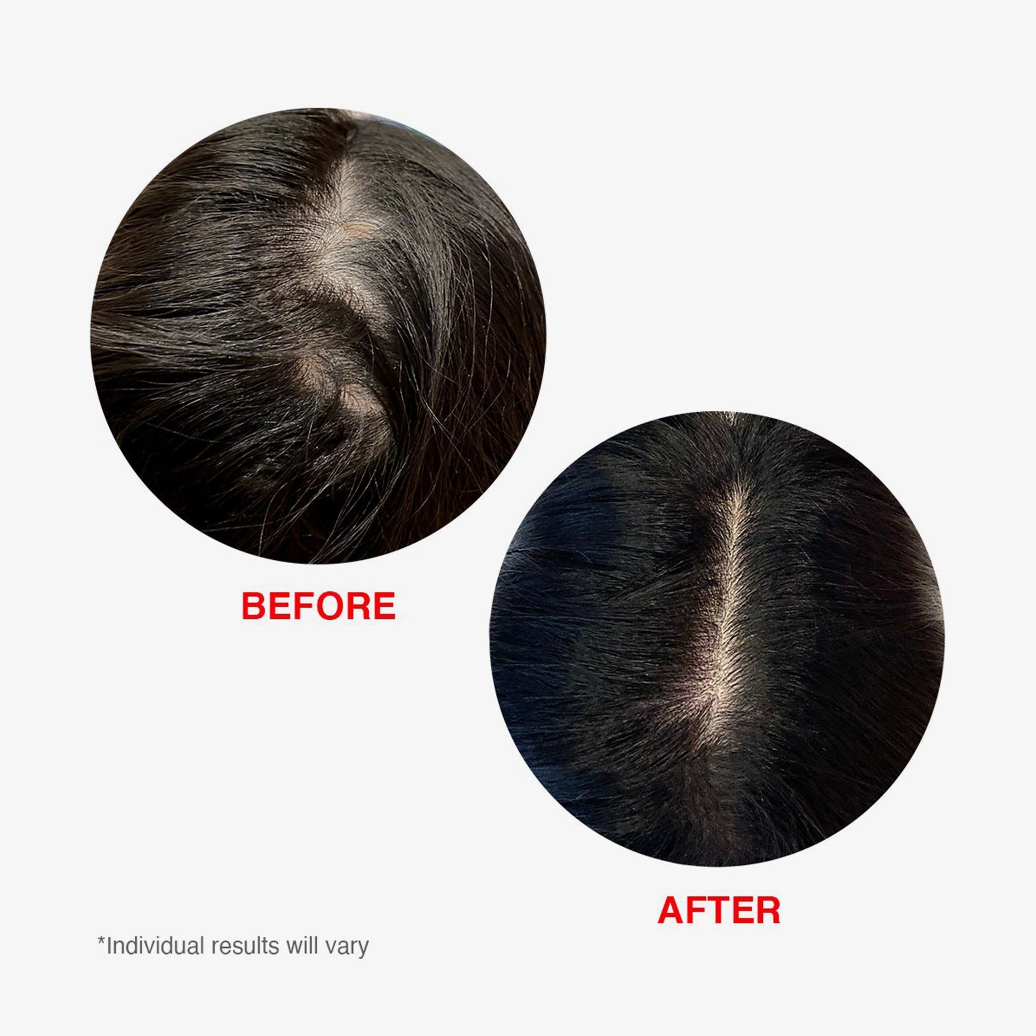 HAIRtamin Scalp Serum
