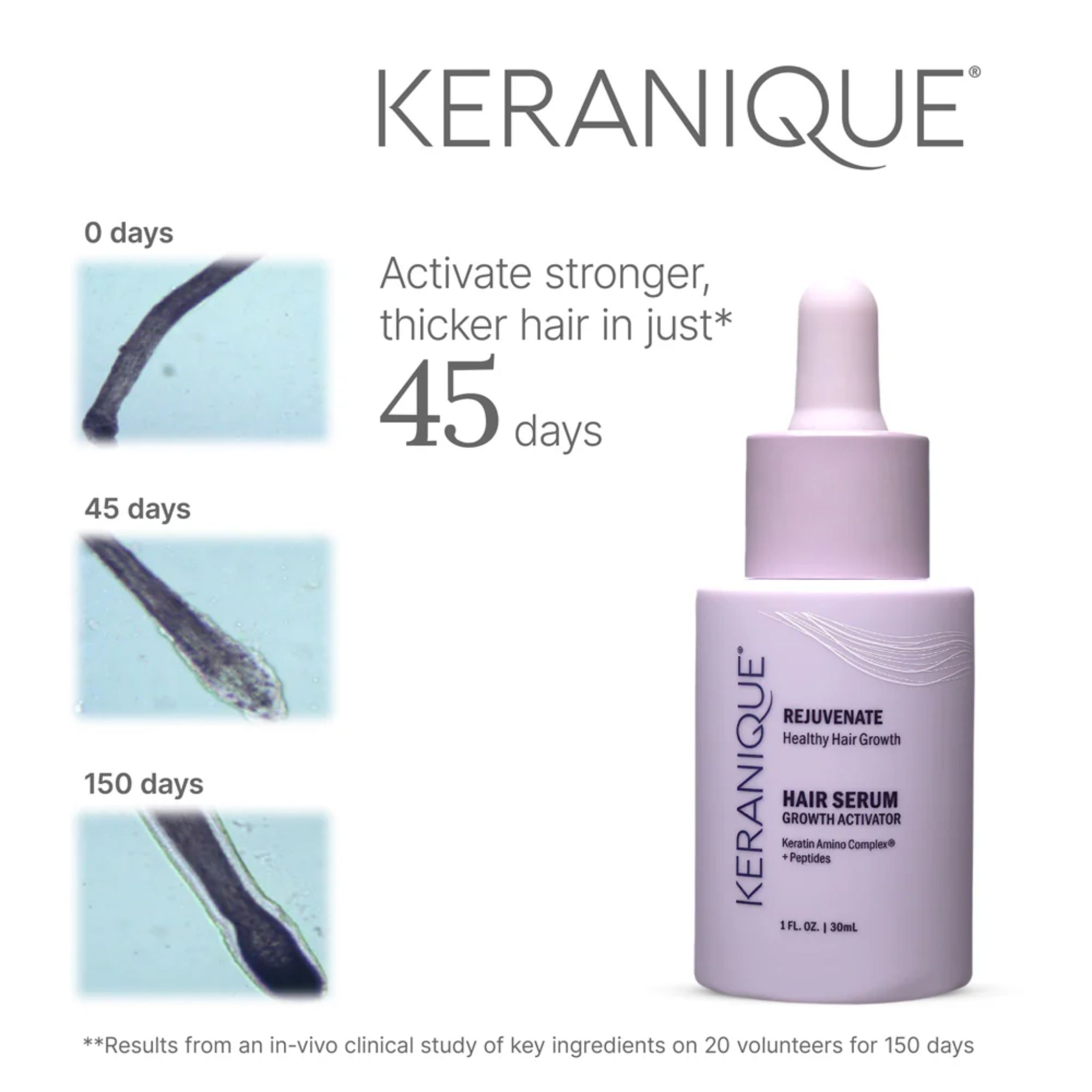 Keranique Hair Serum Growth Activator. Flasche mit Pipette. Mikroskopische Bilder von Haaren.
