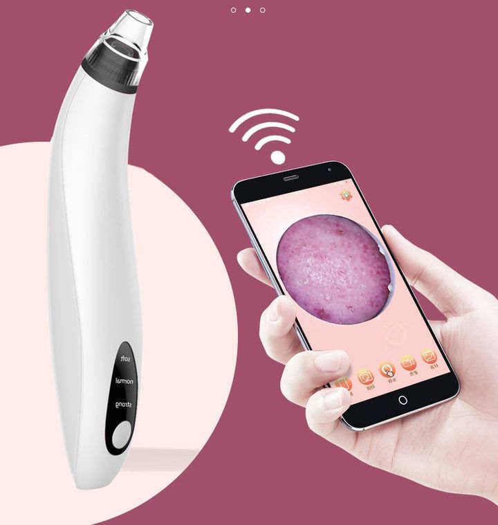 Mitesser-Staubsauger mit integrierter Kamera-PALOMA BEAUTIES