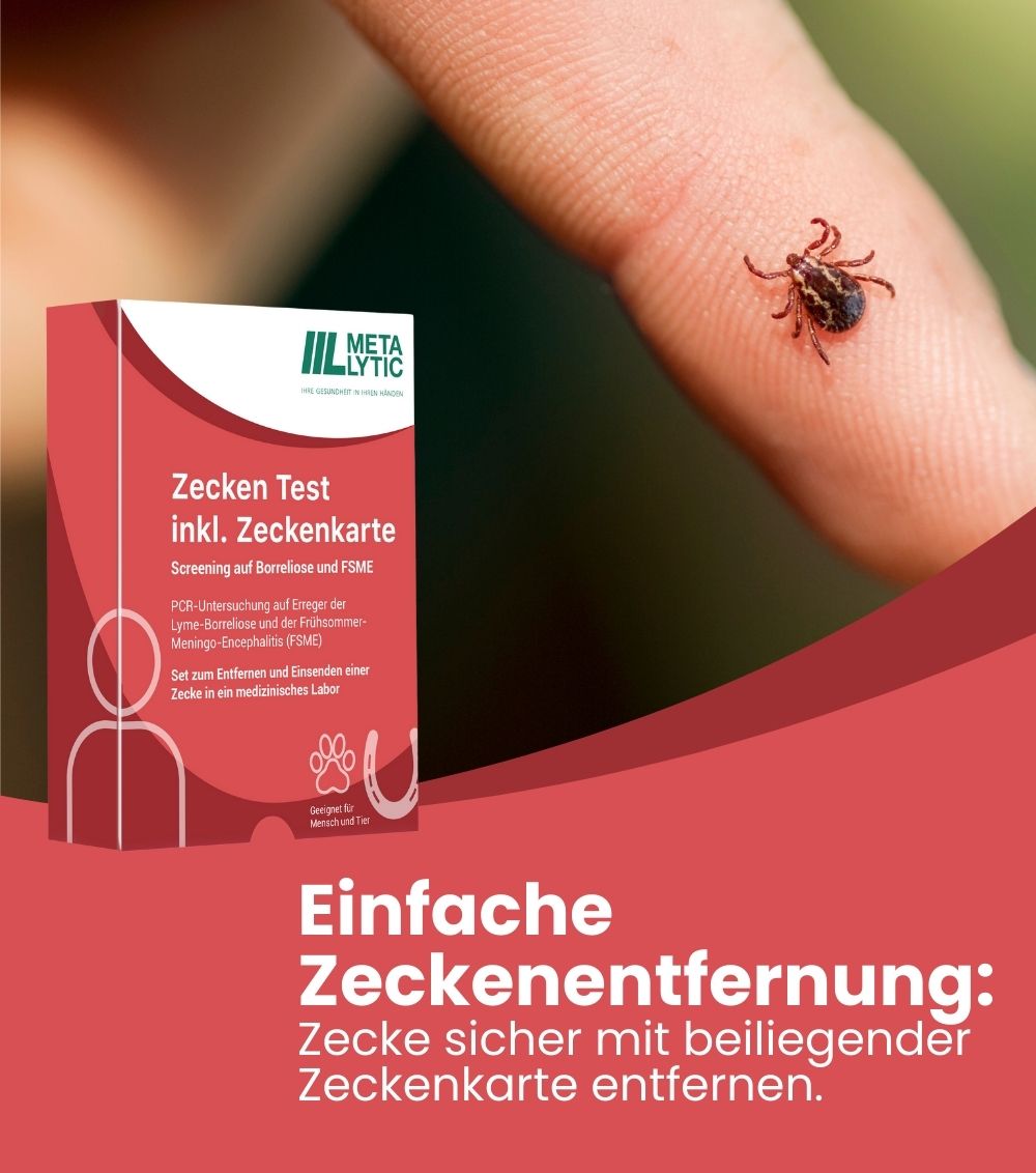 MetaLytic - Borreliose Test & FSME Test nach Zeckenbiss