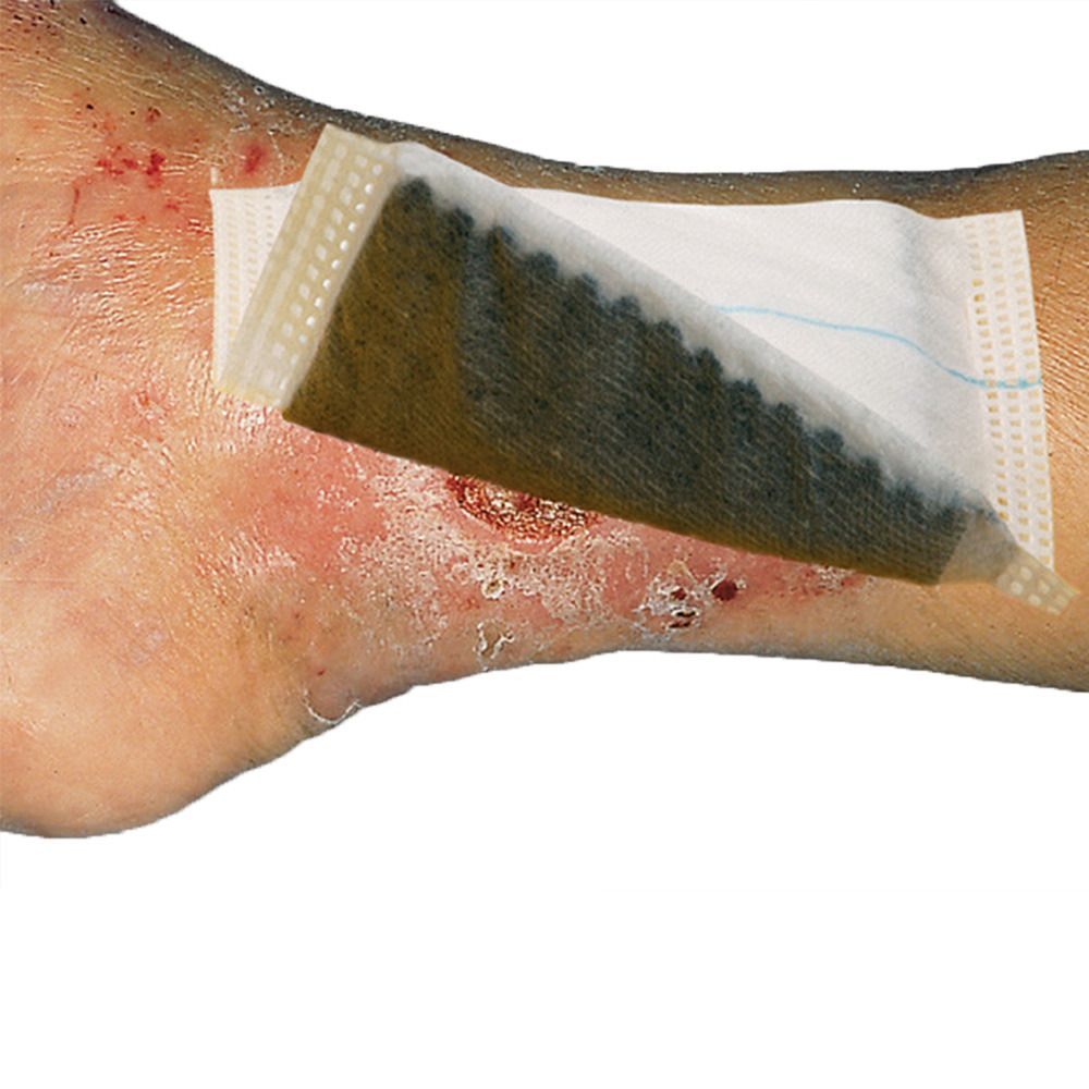 Wundauflage auf Haut. Rechteckige Auflage mit braunem Inhalt. Auf verletzter Haut platziert.