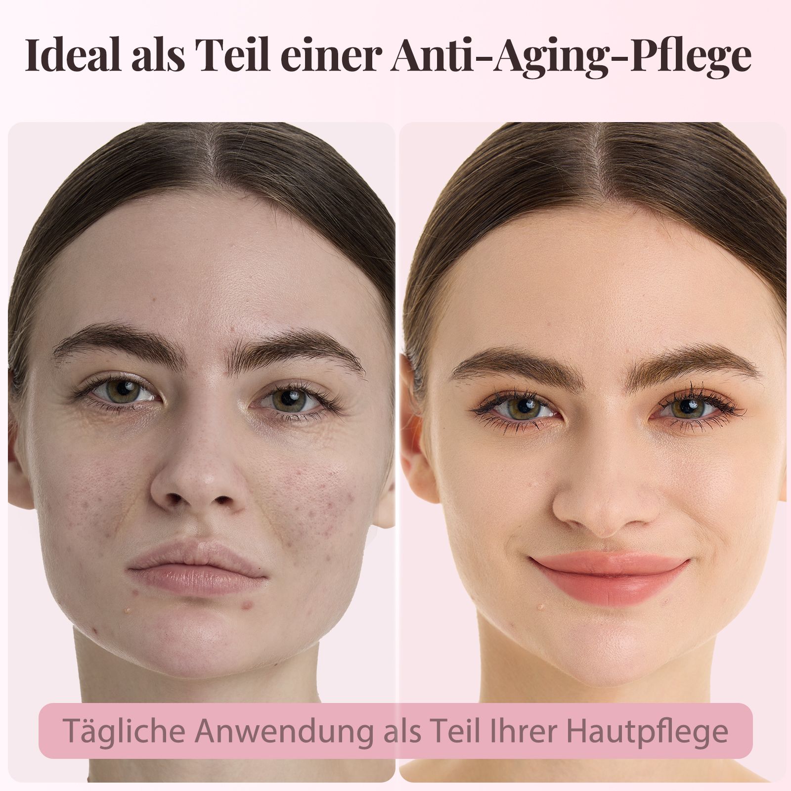Vorher-Nachher-Vergleich. Frau mit Hautunreinheiten, dann glatte Haut. Text: Ideal als Teil einer Anti-Aging-Pflege.