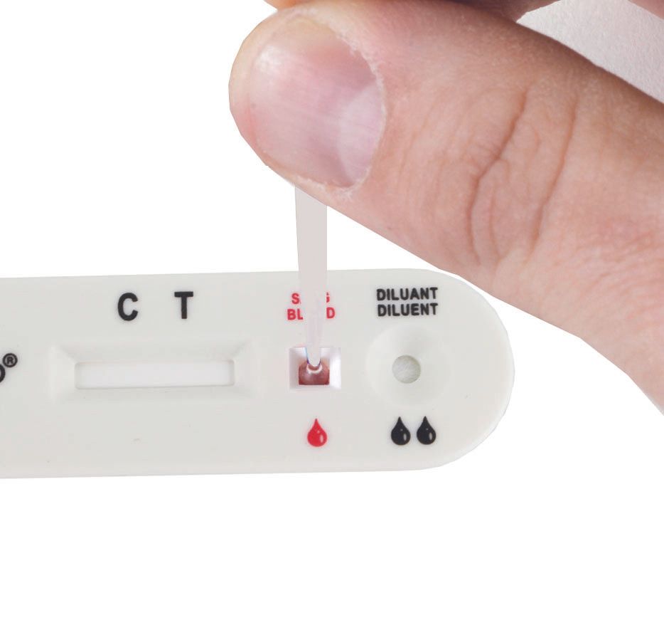 BIOSYNEX Exacto Professional HIV Schnelltest 10 Stück