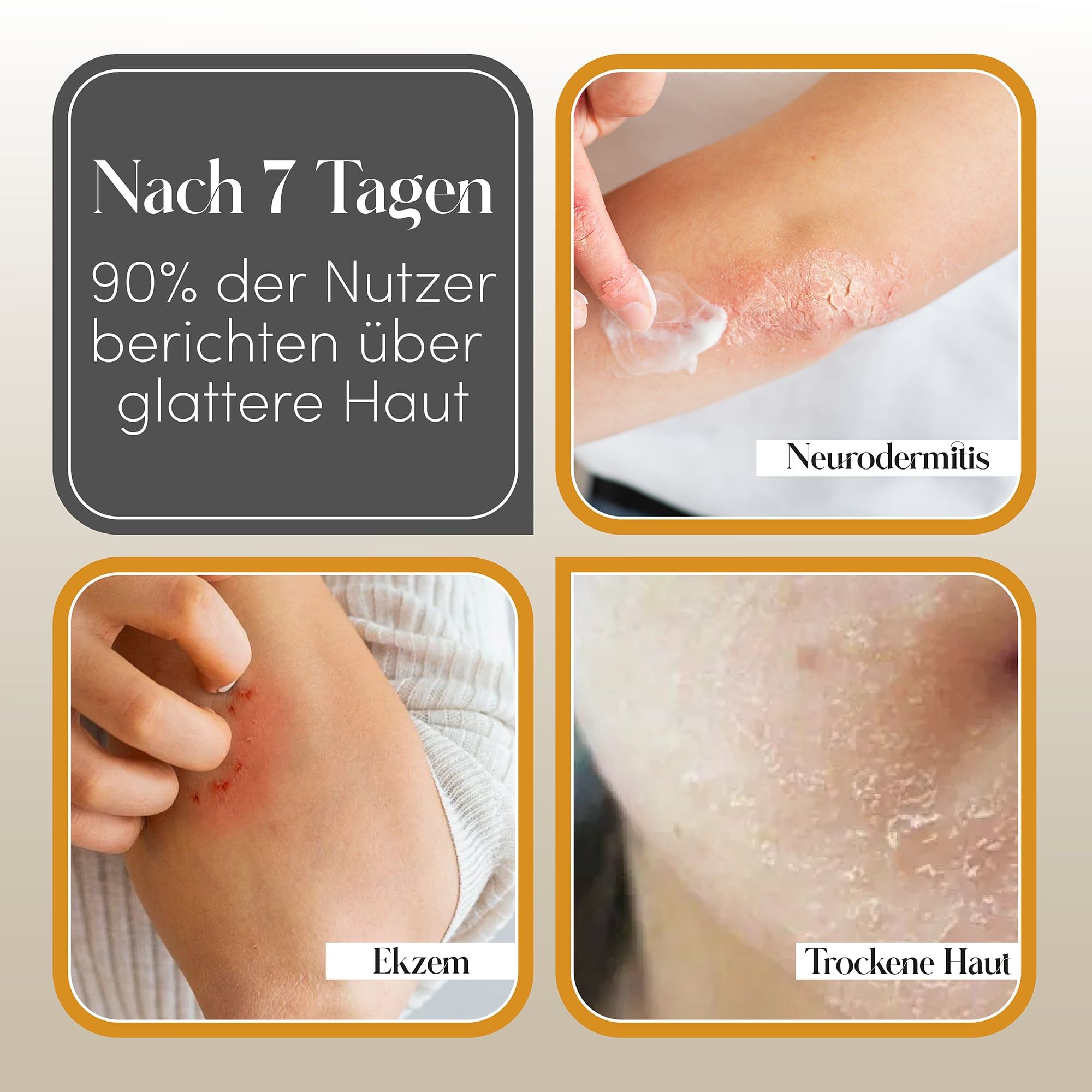 Bilder von Hautproblemen: Neurodermitis, Ekzem, trockene Haut. Text: Nach 7 Tagen berichten 90% der Nutzer über glattere Haut.