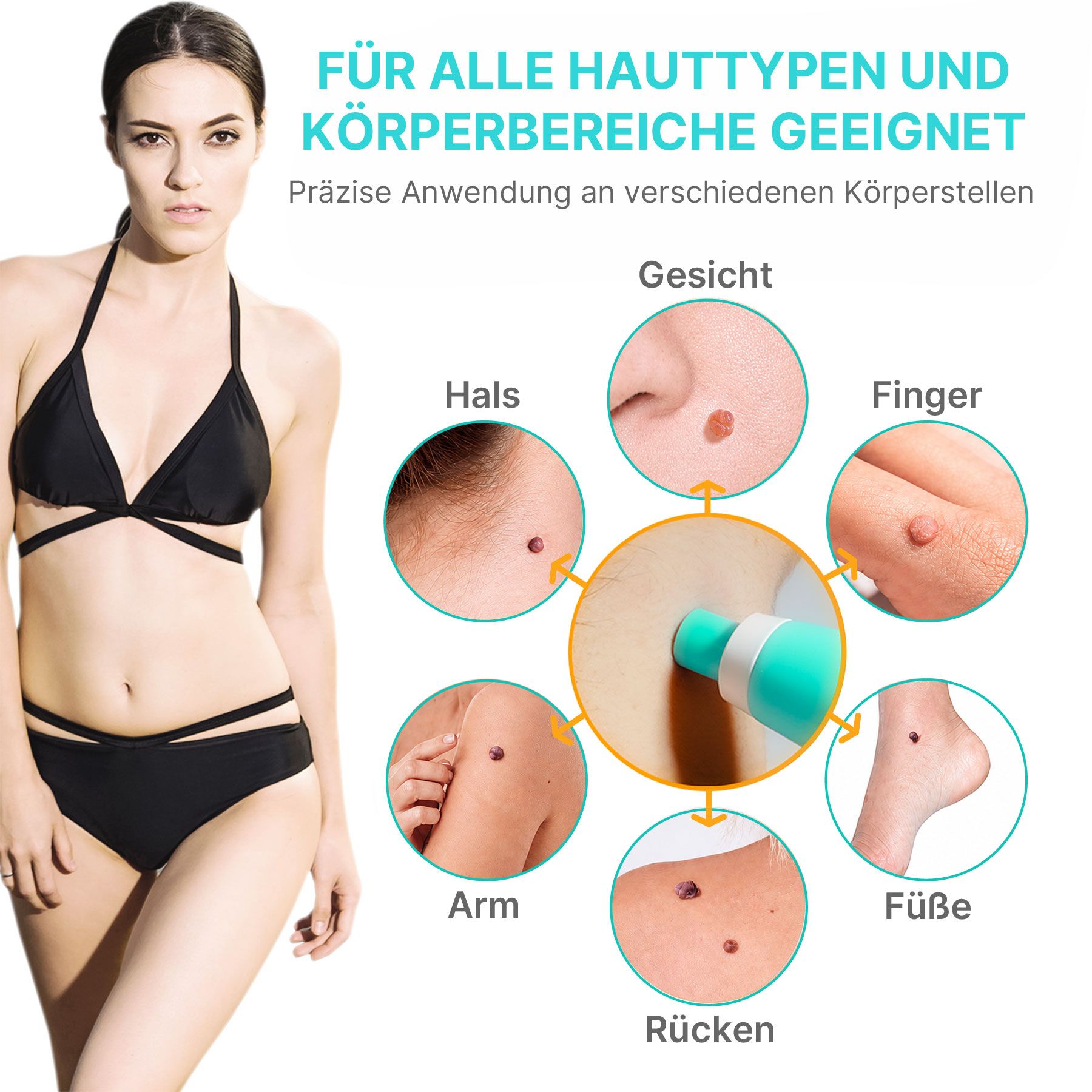 Frau im Bikini neben Infografik, die Hautunreinheiten an Gesicht, Hals, Arm, Rücken, Fingern und Füßen zeigt, mit einem Hautbehandlungsstift.