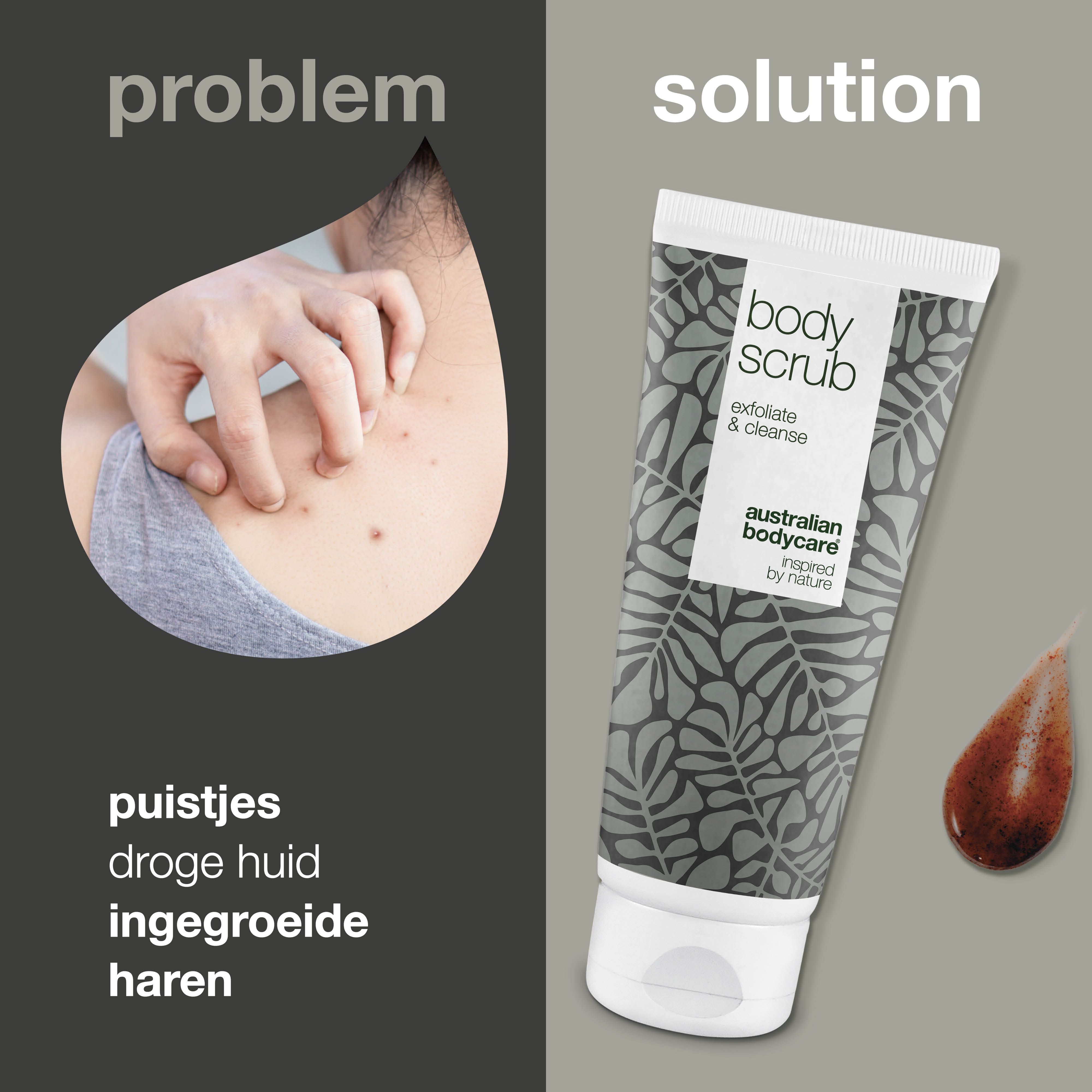 Afbeelding met probleem en oplossing. Links: puistjes, droge huid. Rechts: Body Scrub, Australian Bodycare.