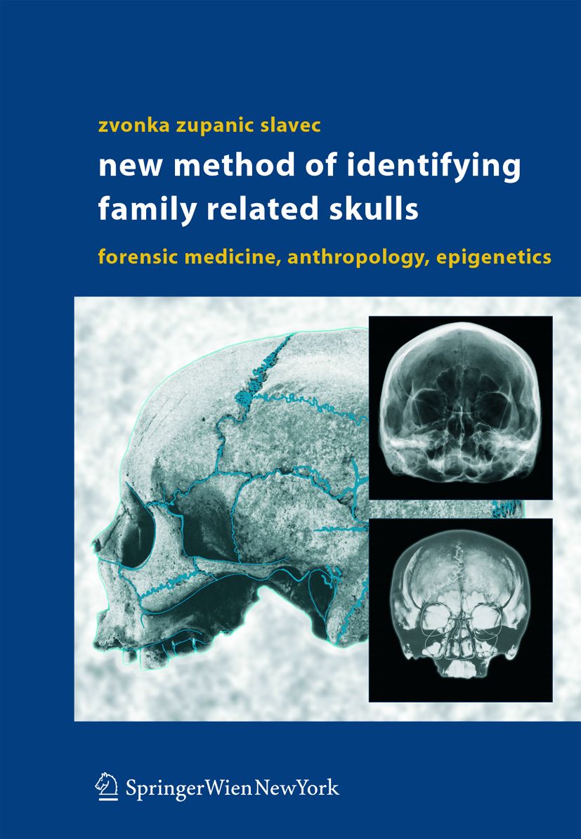 Buchcover mit Schädelabbildung und Röntgenbildern. Titel: New Method of Identifying Family Related Skulls. Autor: Zvonka Zupanic Slavec. Verlag: Springer Wien NewYork.