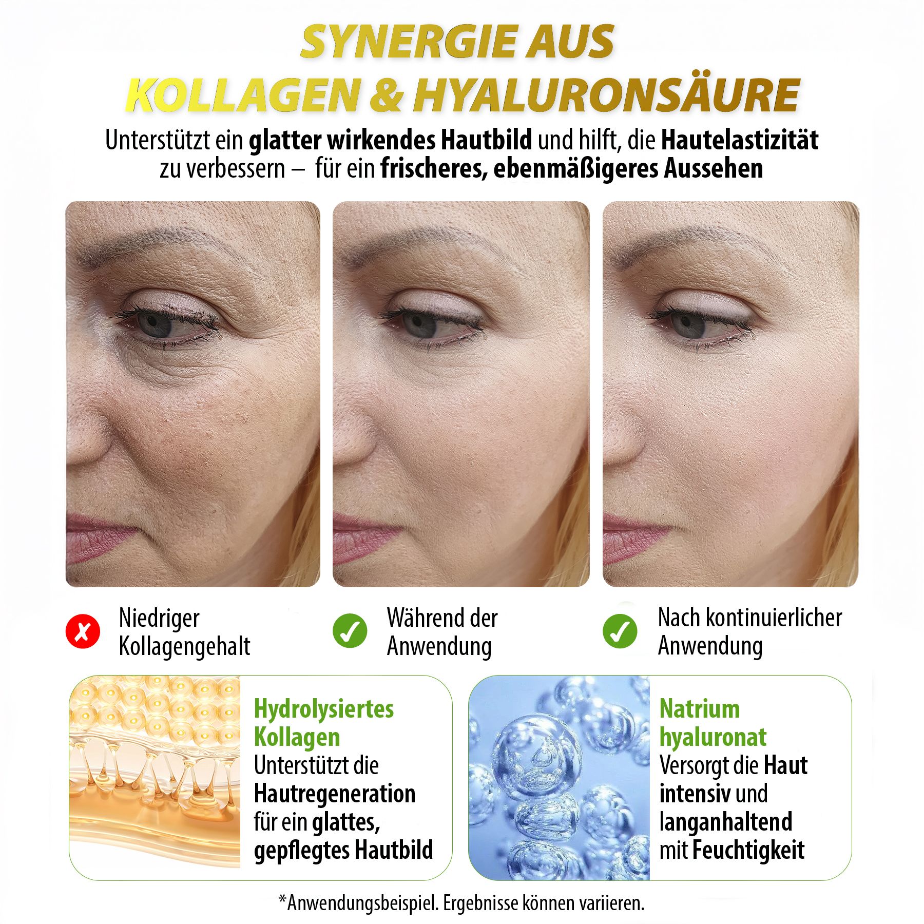 Gesichter. Text: Synergie aus Kollagen & Hyaluronsäure. Vorher/Während/Nach Anwendung. Für glattes Hautbild.