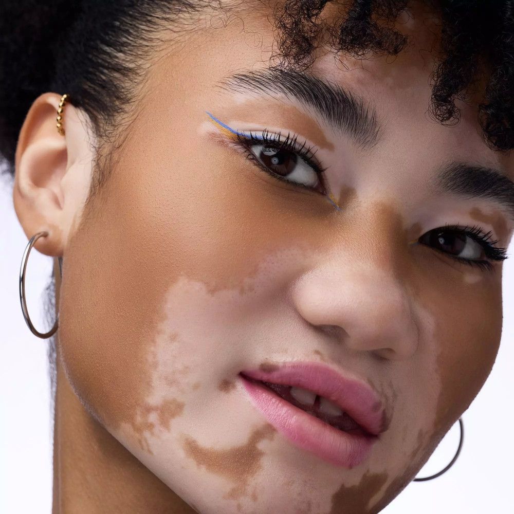 Porträt einer Frau mit blauem Eyeliner. Haut mit Pigmentflecken.