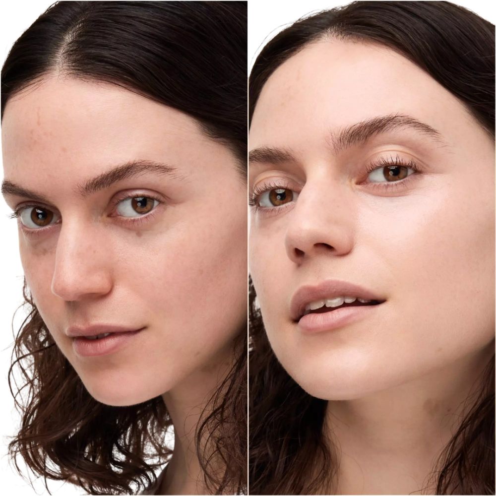 Zwei Gesichter. Vorher und Nachher. Keine Beschriftung sichtbar.