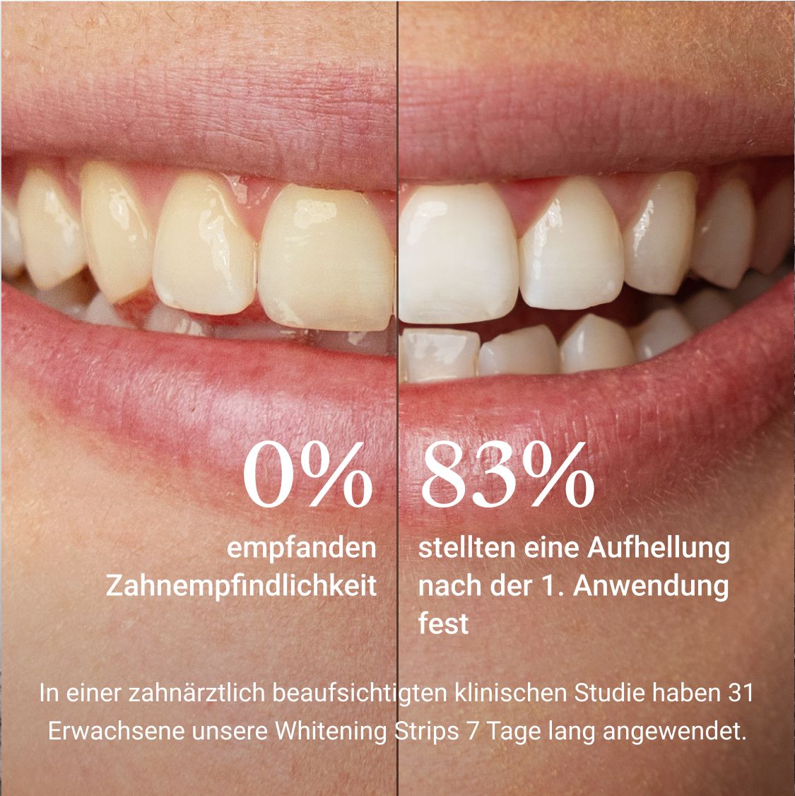 ALPINE WHITE Sensitive Whitening Strips