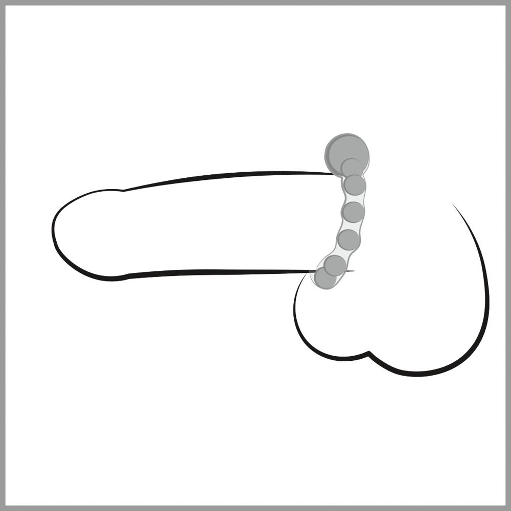 Strichzeichnung eines Penis mit Maximum Metal Ring. Ring mit Perlen. Metallperlen.