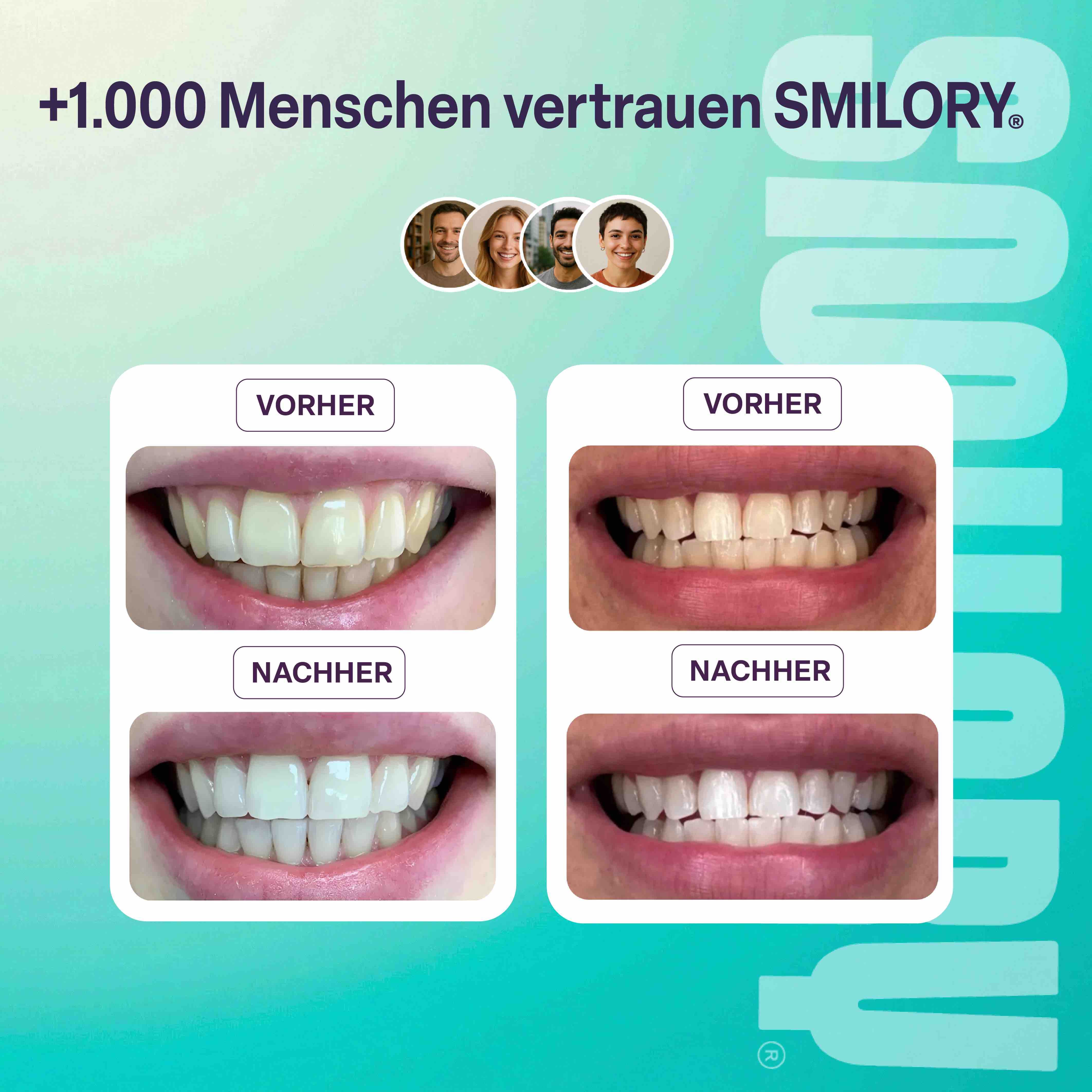 Smilory® Space Light - Professionelles Zahnaufhellungsset