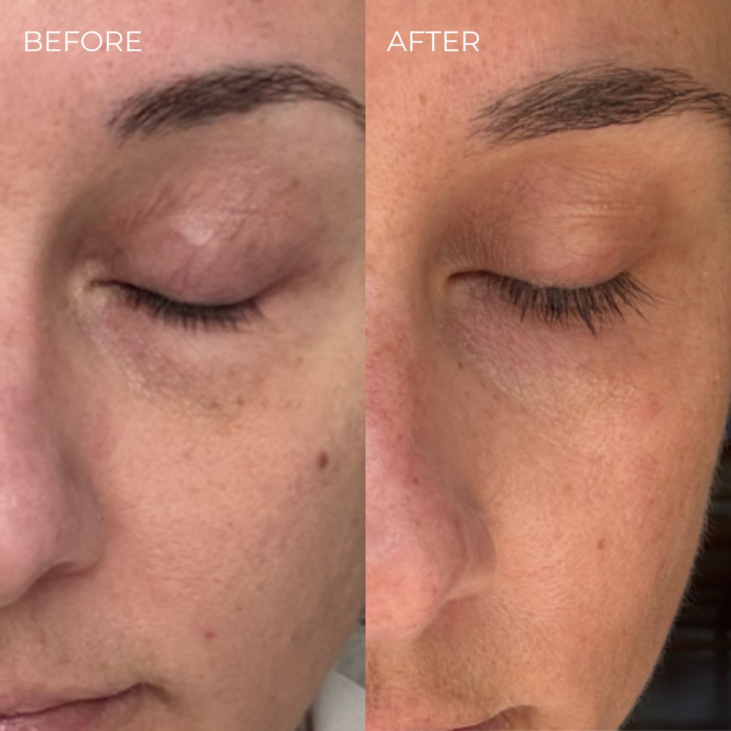 Vorher-Nachher-Vergleich. Nahaufnahme eines Auges. Links: geschlossenes Auge. Rechts: Auge mit längeren Wimpern.
