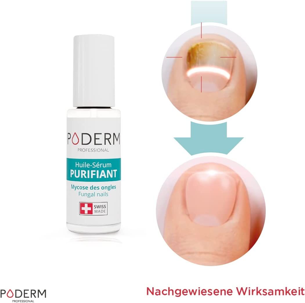 PODERM - NAGELPILZ-BEHANDLUNG Mit der Kraft antimykotischer, reparierender, reinigender