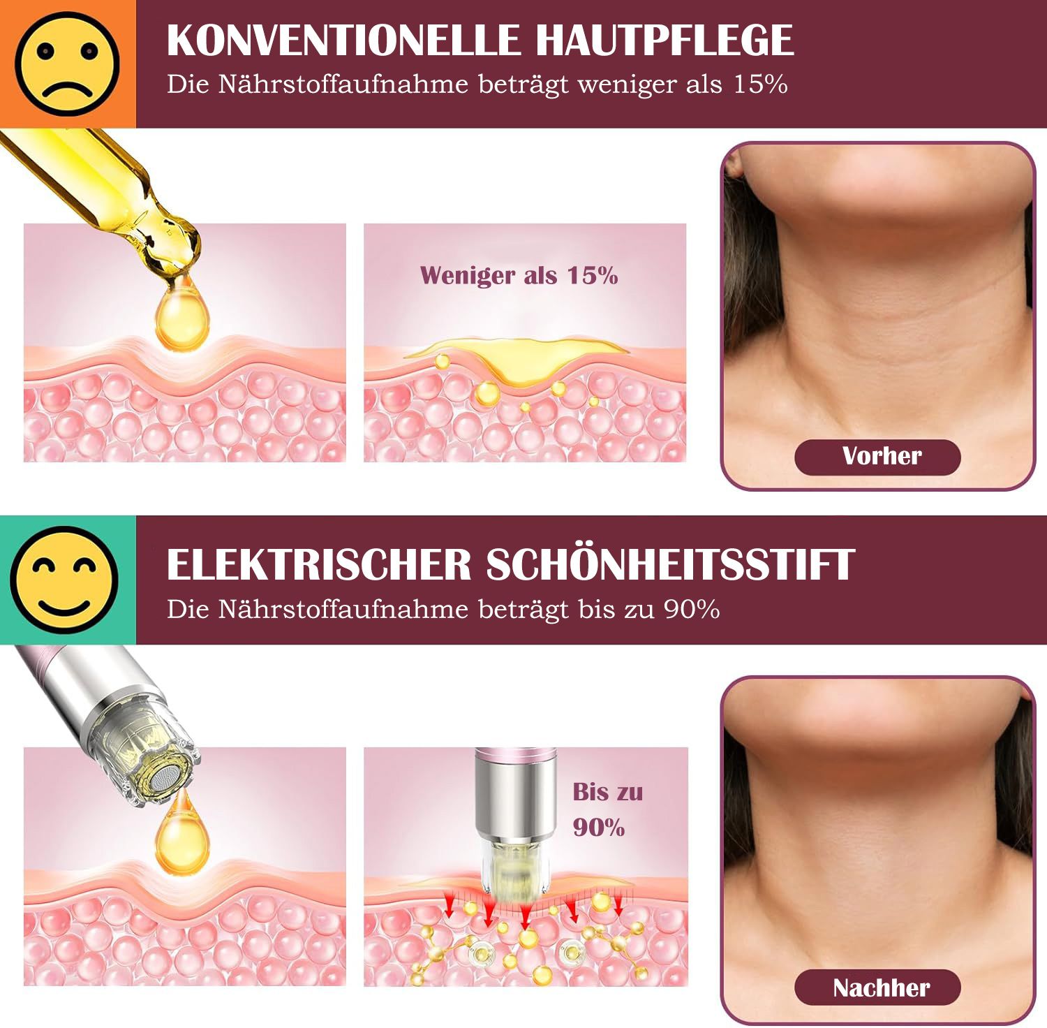 COOL-i Microneedling Pen mit Serum Auftrag ,kabellos, 5 Stufen & Patronen für Hautpflege A3