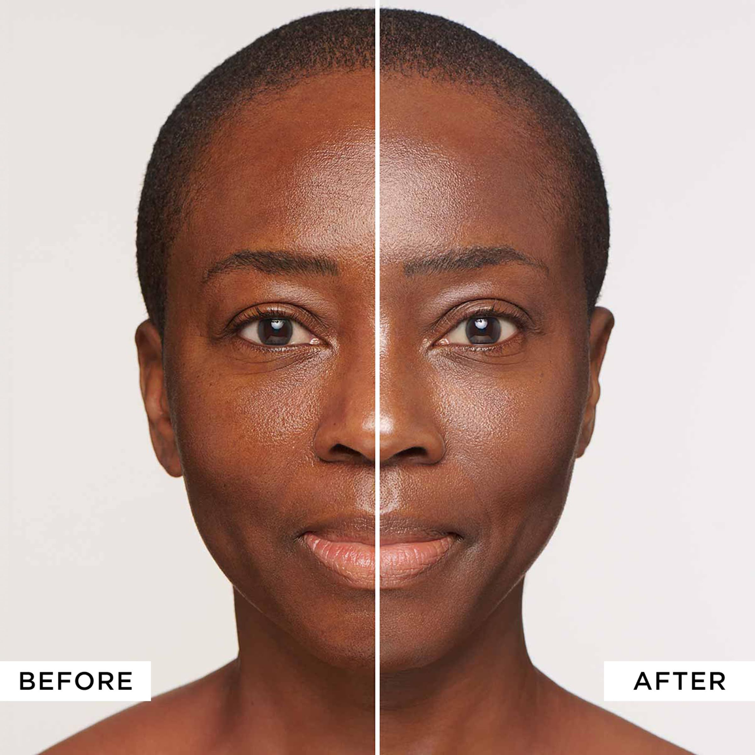 Gesicht, links: vorher, rechts: nachher. Hautton verbessert.