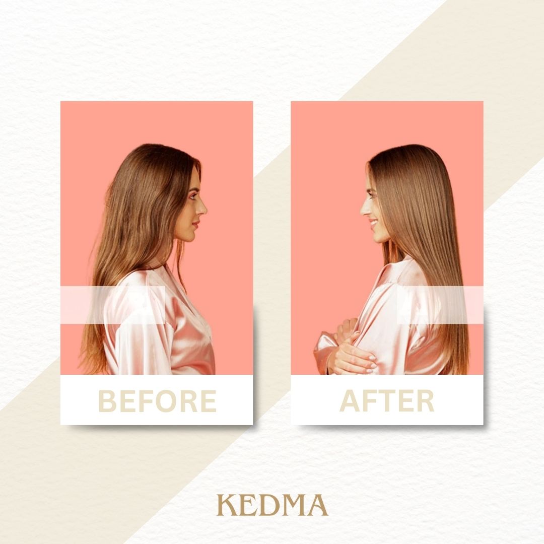 Kedma - Haarwurzeln-Stimulator