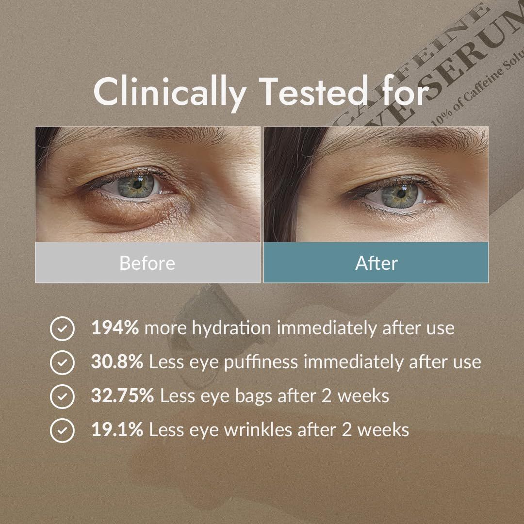Vorher-Nachher-Vergleich von Augen. Text: Klinisch getestet. Ergebnisse: Hydratation, Schwellungen, Tränensäcke, Falten.