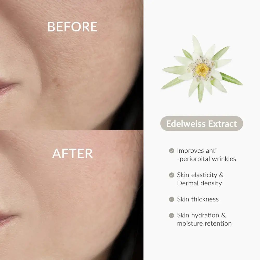 Vorher-Nachher-Vergleich von Haut. Edelweiß-Extrakt-Informationen: Anti-Falten, Elastizität, Dicke, Feuchtigkeit.
