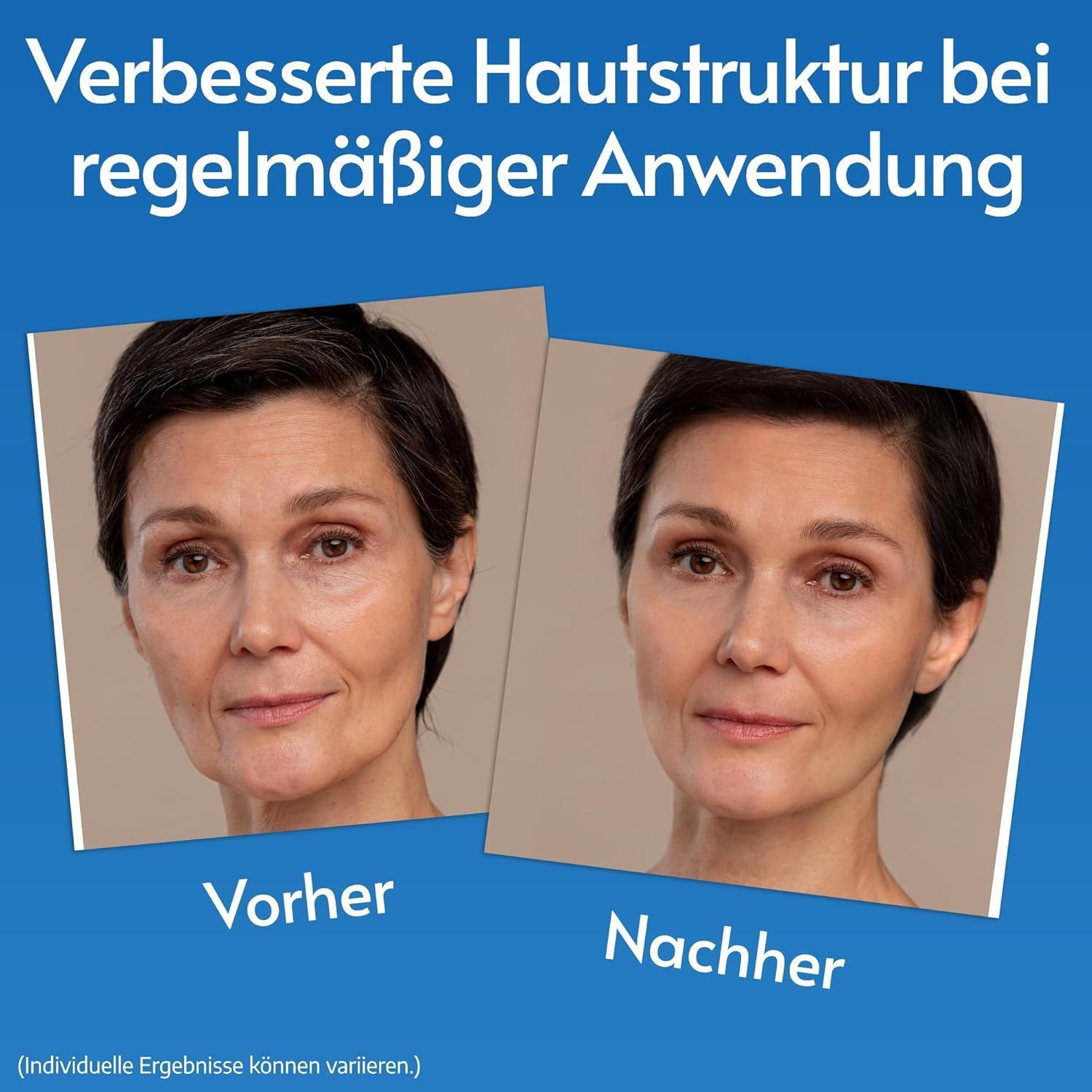 Vorher-Nachher-Vergleich. Frau mit Falten, dann glattere Haut. Text: Verbessert Hautstruktur bei regelmäßiger Anwendung.