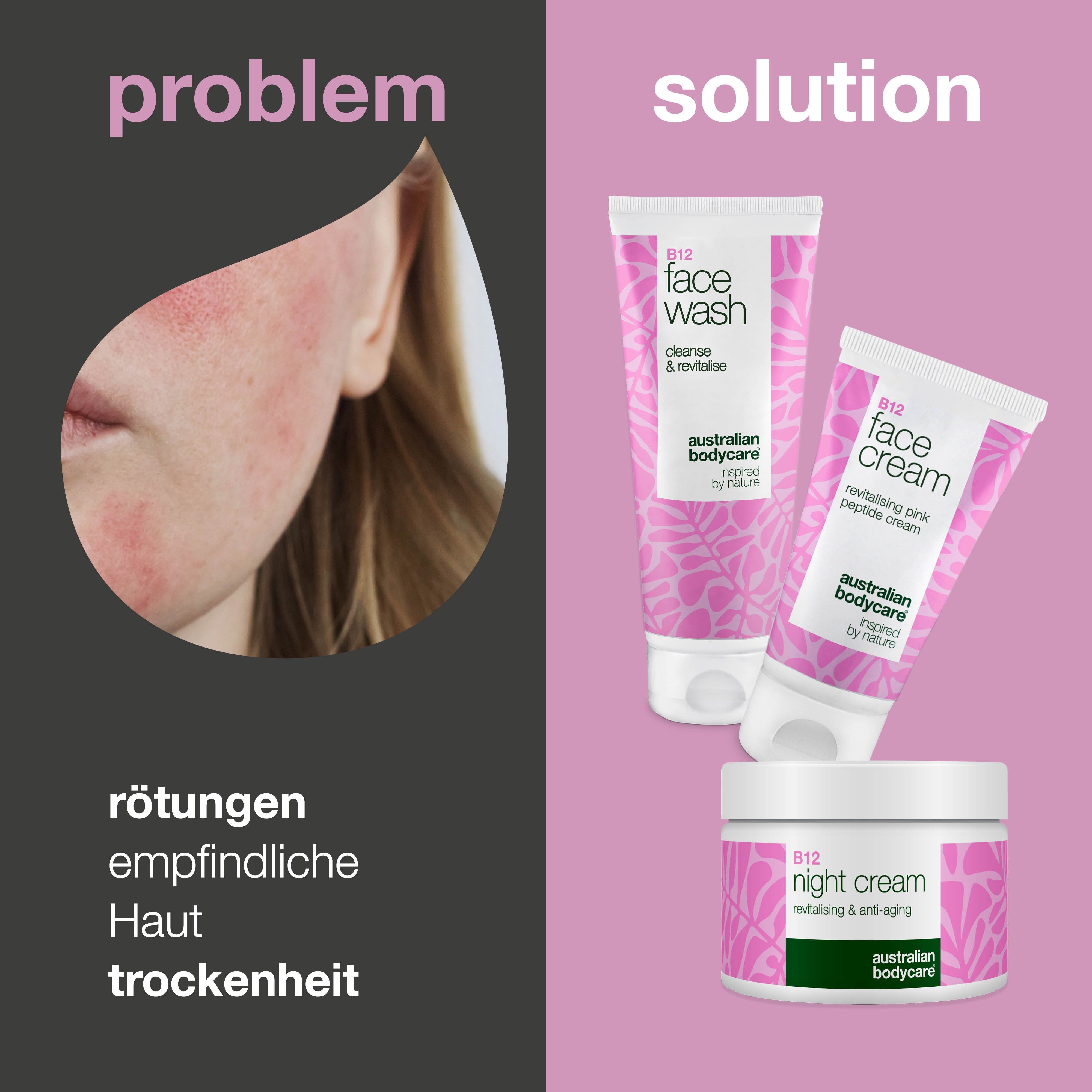 Gesicht mit Rötungen. Daneben Face Wash, Face Cream und Night Cream. Text: Rötungen, empfindliche Haut, Trockenheit.