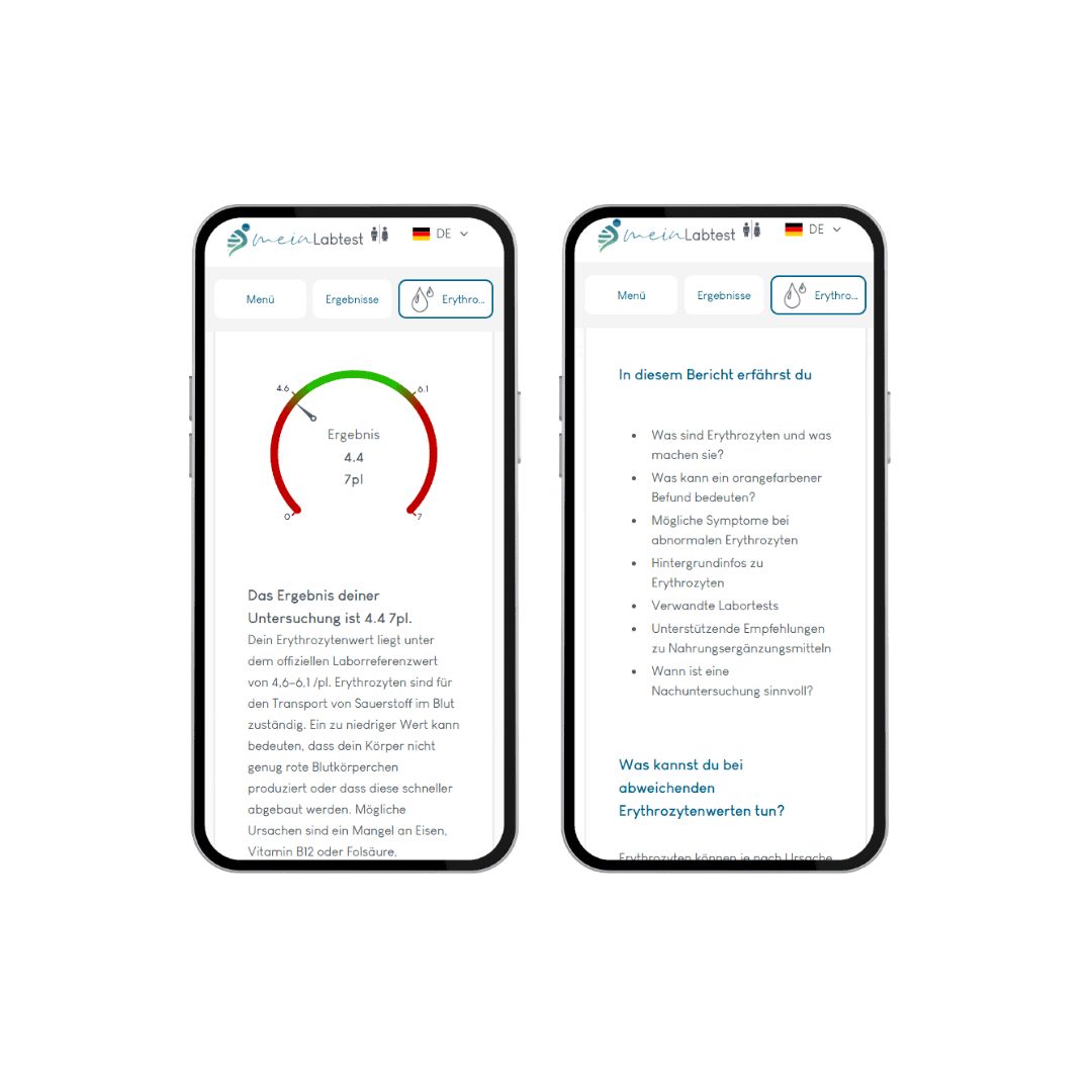 Zwei Smartphones mit Testergebnissen. Auf dem linken Smartphone "Ergebnisse". Auf dem rechten Smartphone Informationen.