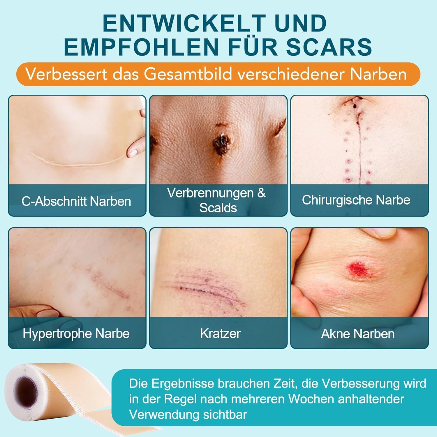 HUALIJIA Silikon Narbenpflaster für die Haut