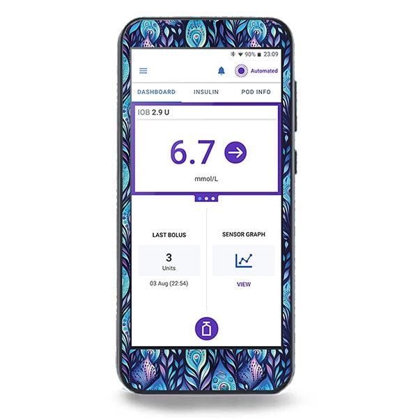 Smartphone mit Diasticker® Omnipod 5 Sticker „Batik Peacock“. Bildschirm zeigt Gesundheitsdaten. Blaues Feder-Muster.