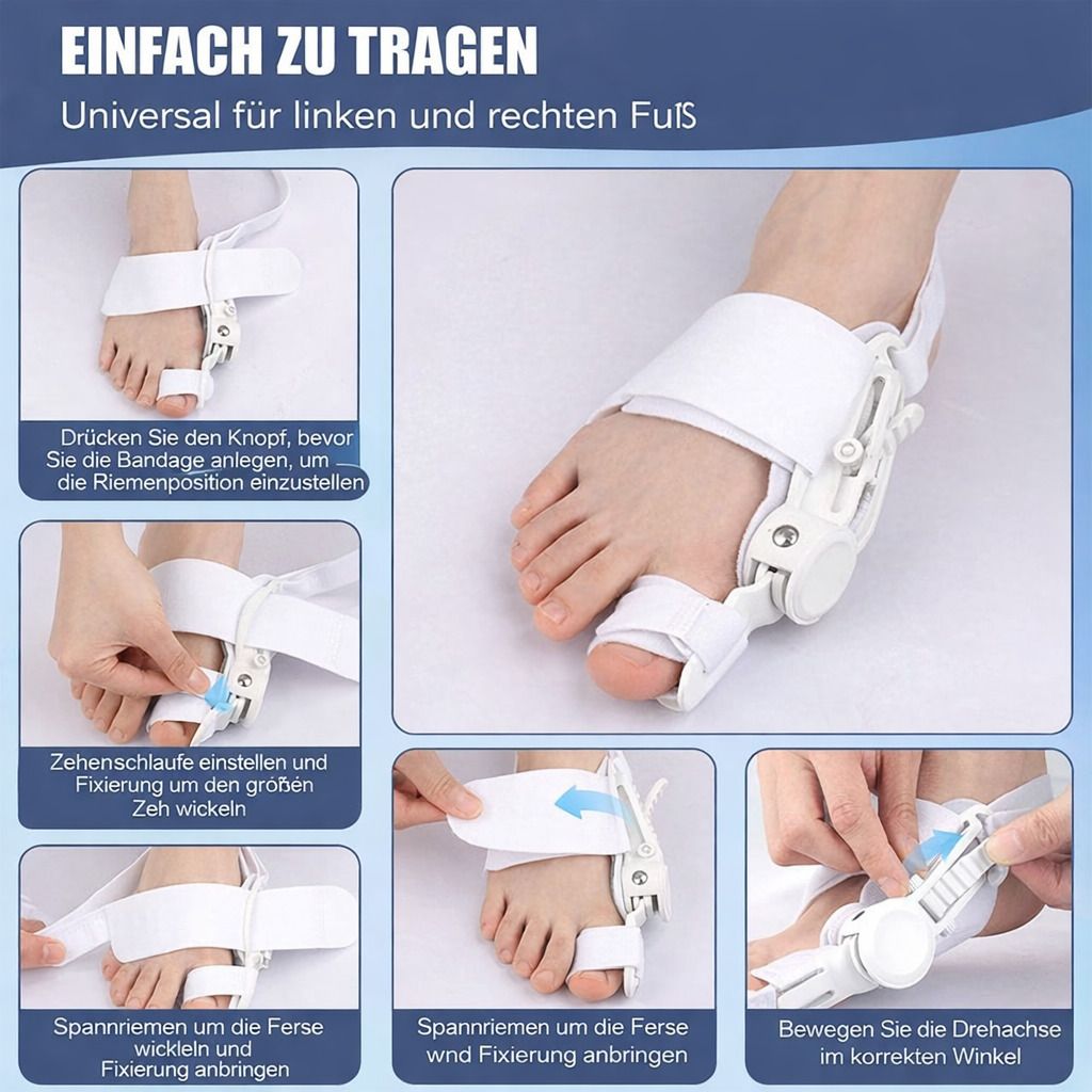 Hallux valgus Korrektor am Fuß. Weißes Design, Anwendungsschritte: Zehenschlaufe einstellen, Ferse fixieren, Drehachse anpassen. Universal für links und rechts.