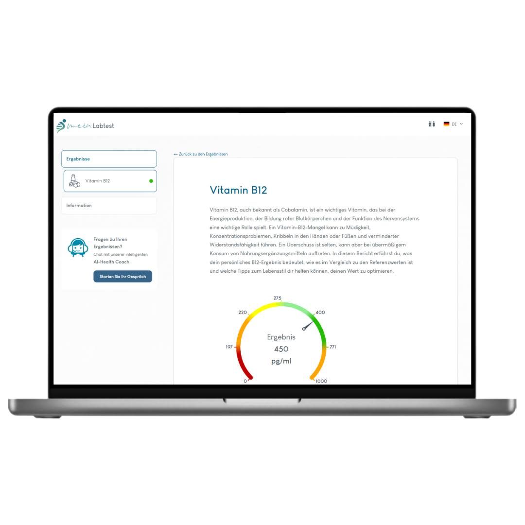 Laptop mit Testergebnissen. Auf dem Bildschirm: Vitamin B12-Informationen und Diagramm. Logo von meinLabtest.