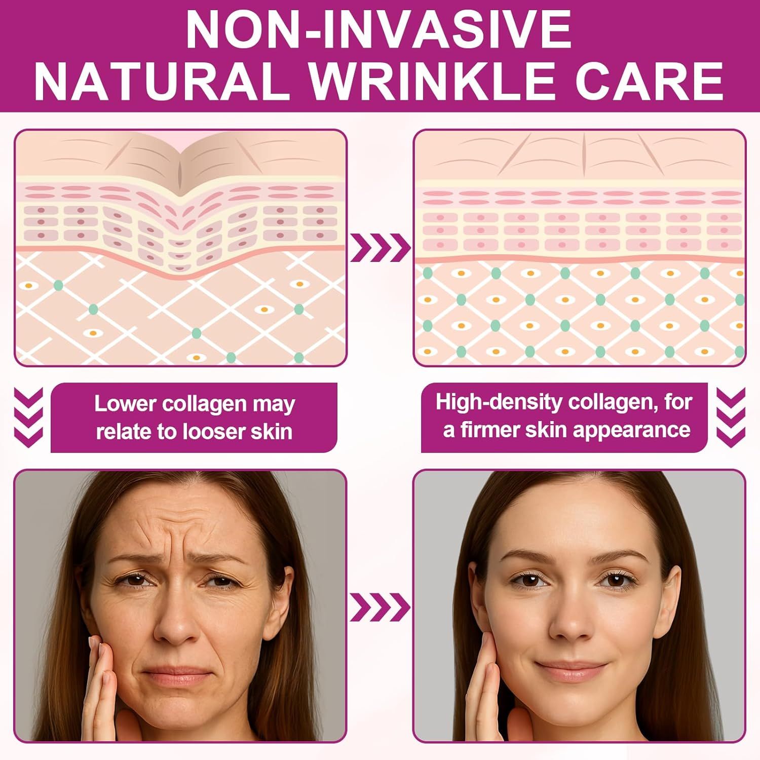 Vergleich Vorher/Nachher. Text: Non-invasive natural wrinkle care. Weniger Kollagen, festere Haut. Vorher: Falten. Nachher: Glattere Haut.