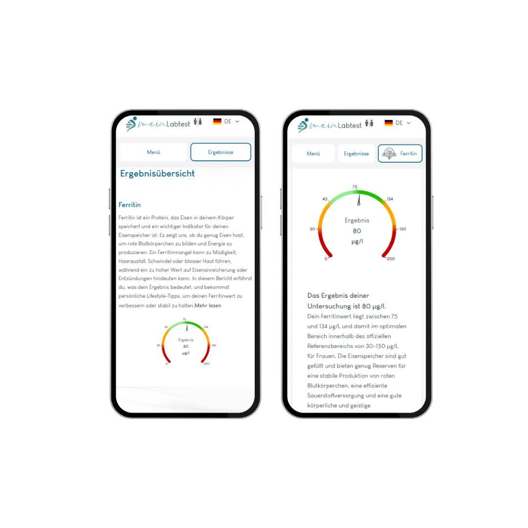 Zwei Smartphones mit Ergebnisübersicht. Anzeige von Testergebnissen. Logo von meinLabtest.de.