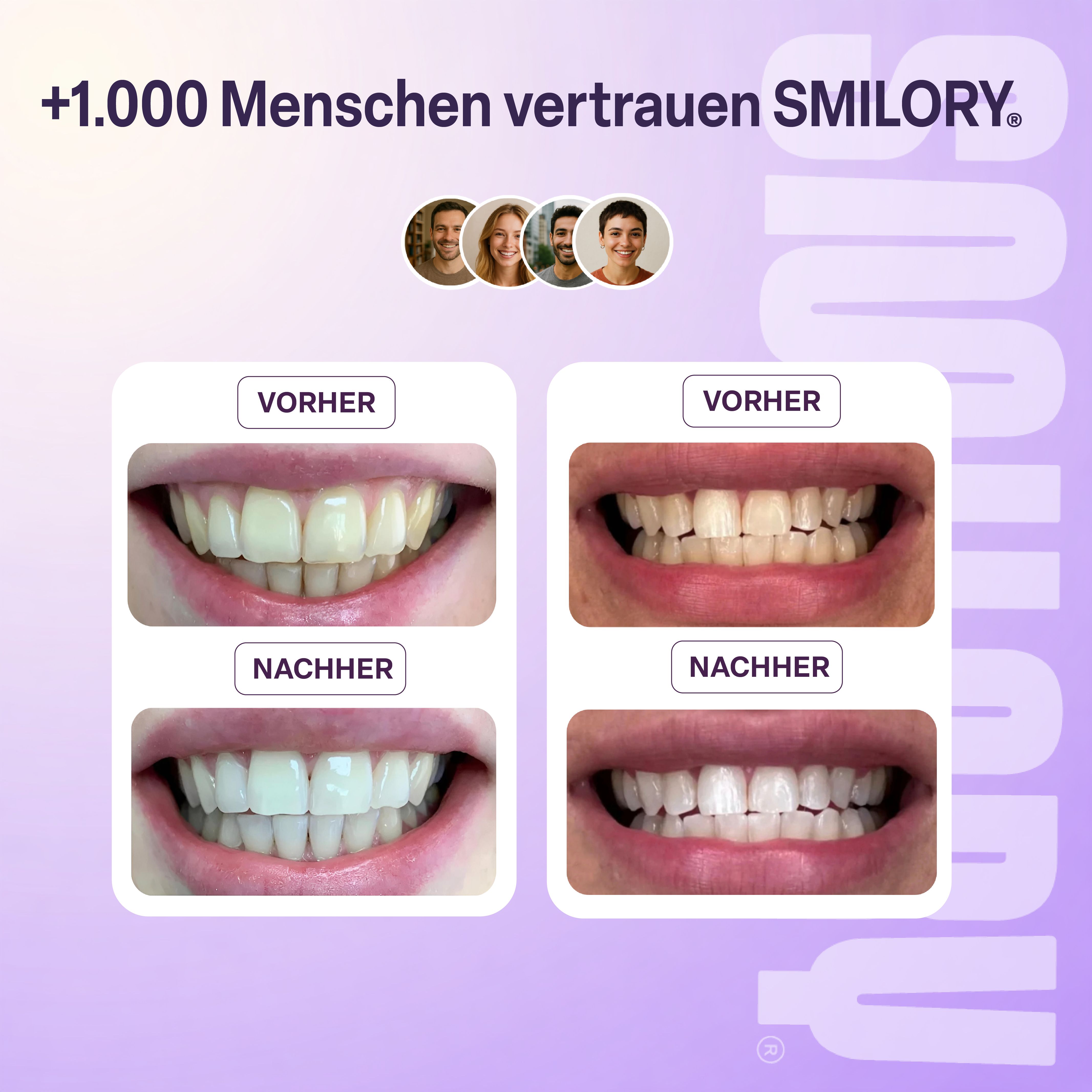 Smilory® Lila Whitining Zahnpaste