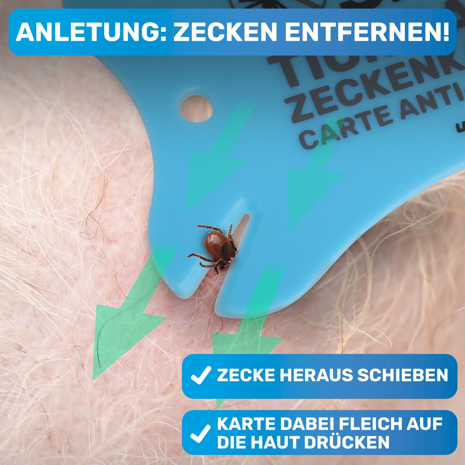 BluePet Zeckenkarte Zeckenentferner  mit Lupe