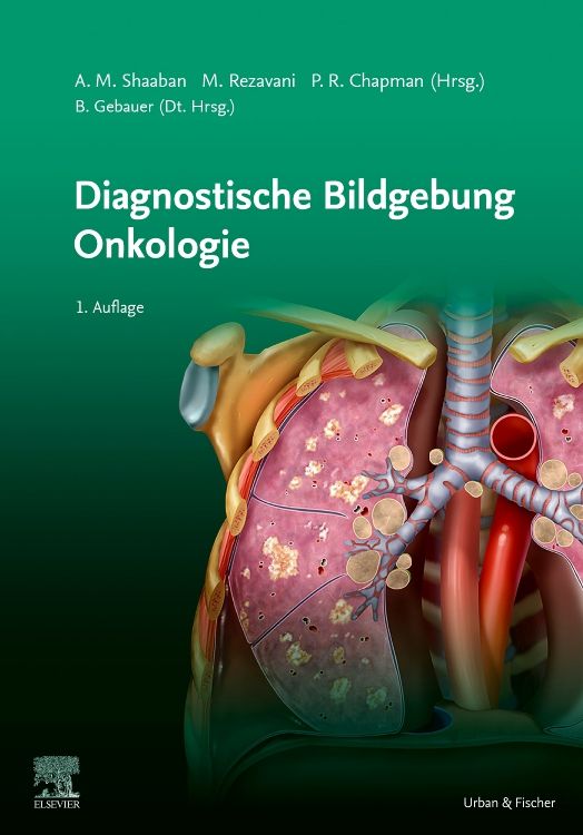 Buchcover: Diagnostische Bildgebung Onkologie. Titel, Autoren, und Illustration von Lunge mit Tumoren. Verlag Elsevier.