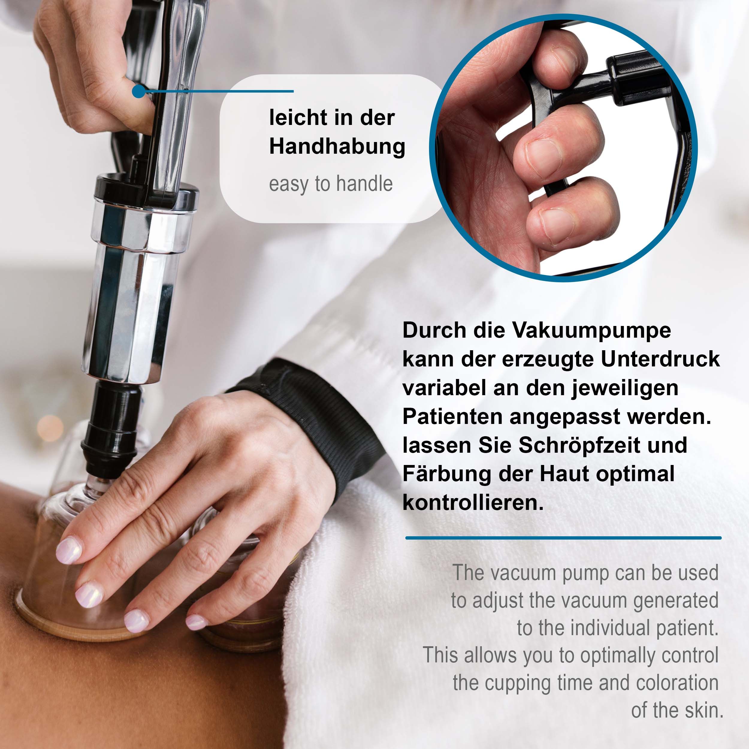 Vakuumpumpe in Anwendung. Schwarzer Griff, silberner Zylinder. Ermöglicht Anpassung des Vakuums. Optimale Kontrolle der Schröpfzeit.