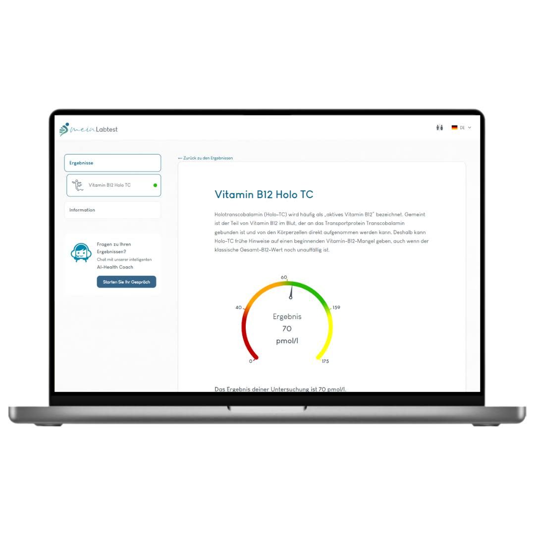 Laptop mit Testergebnis-Anzeige: Vitamin B12 Holo TC. Farbskala von rot bis grün. Ergebnis: 70 pmol/l.