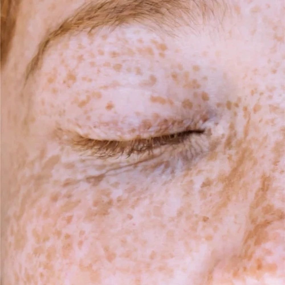 Zero Skin Vitamin C Serum, strahlkraftfördernd glättend für trockene und reife Haut