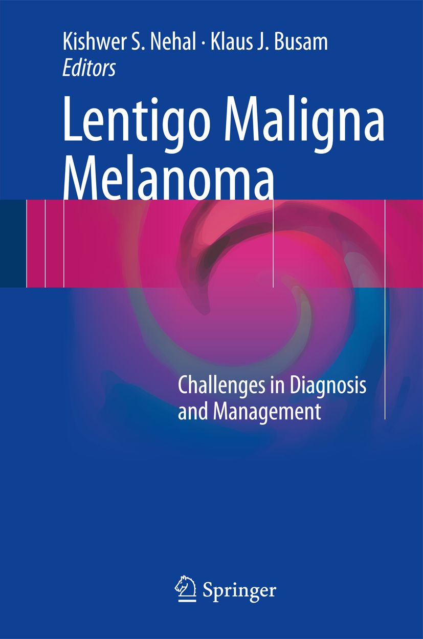 Buchcover: "Lentigo Maligna Melanoma". Titel in Weiß auf blauem Hintergrund. Herausgeber: Kishwer S. Nehal, Klaus J. Busam. Verlag: Springer.