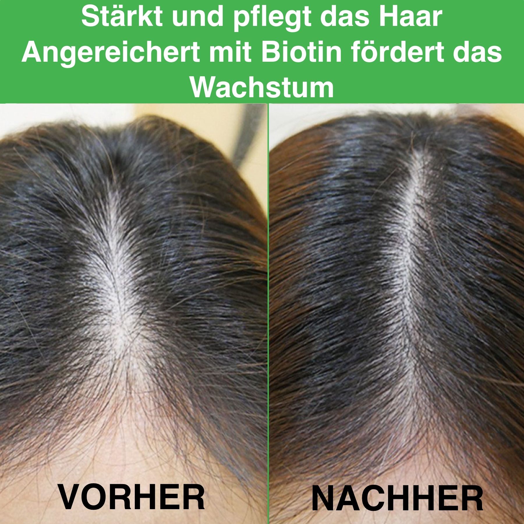 Vorher-Nachher-Bild. Haaransatz. Text: Stärkt und pflegt das Haar. Angereichert mit Biotin.