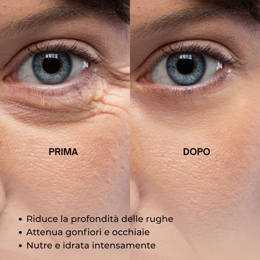 Confronto occhi prima e dopo l'uso. Testo: Riduce la profondità delle rughe, attenua occhiaie e gonfiori.