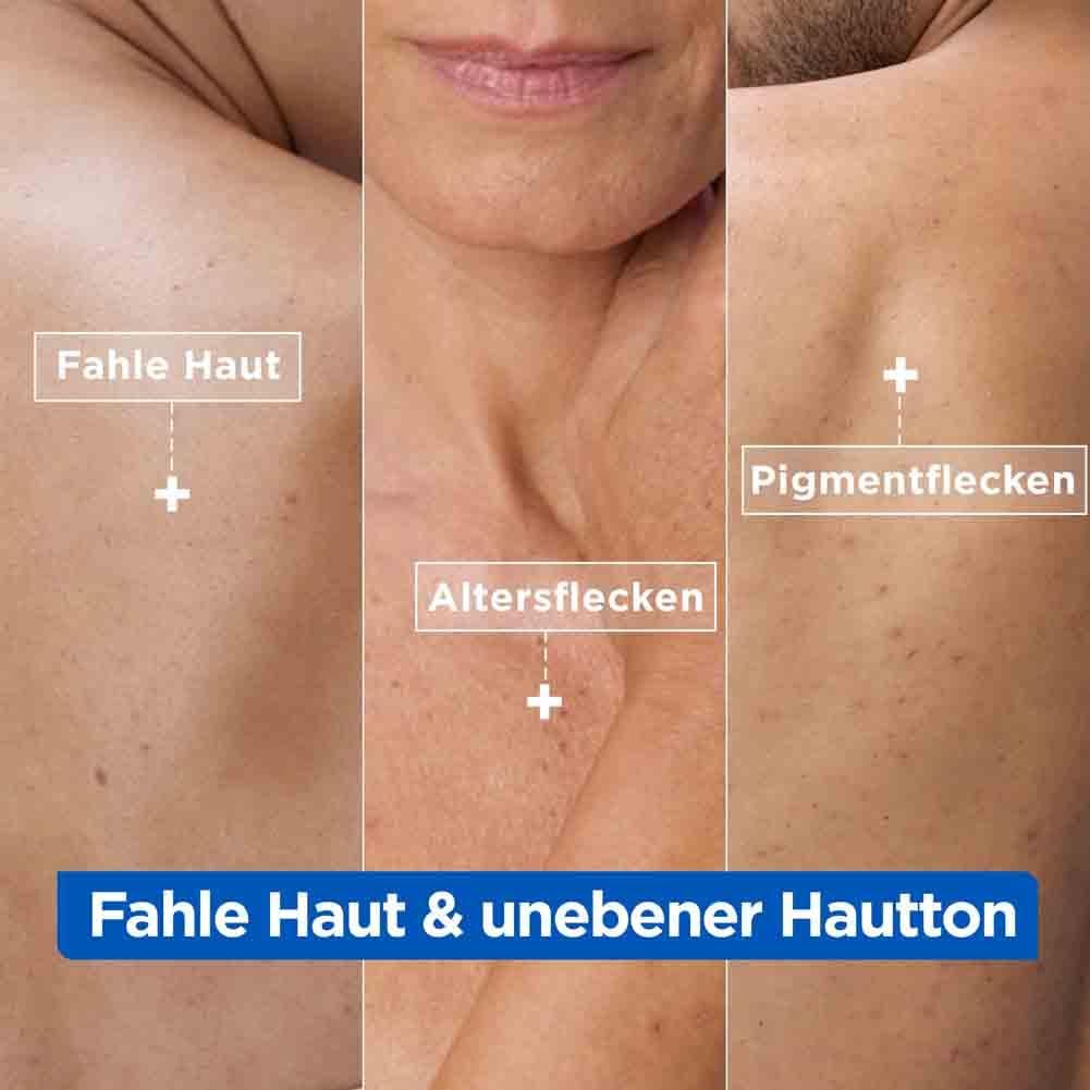 Mixa Niacinamide Bright Anti Pigmentflecken