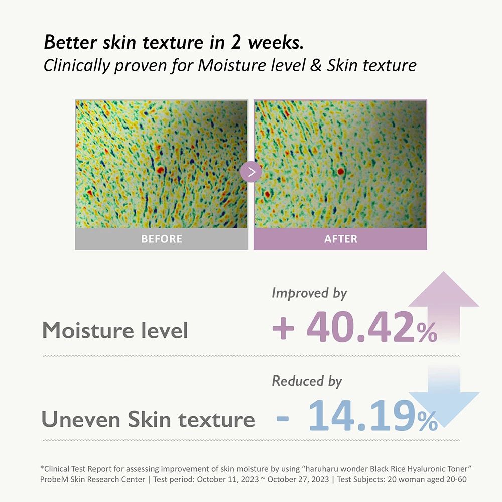 HARUHARU WONDER Black Rice Hyaluronic Toner – Feuchtigkeitsspendender Gesichtstoner