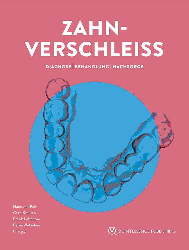 Zahnverschleiß Diagnose | Behandlung | Nachsorge