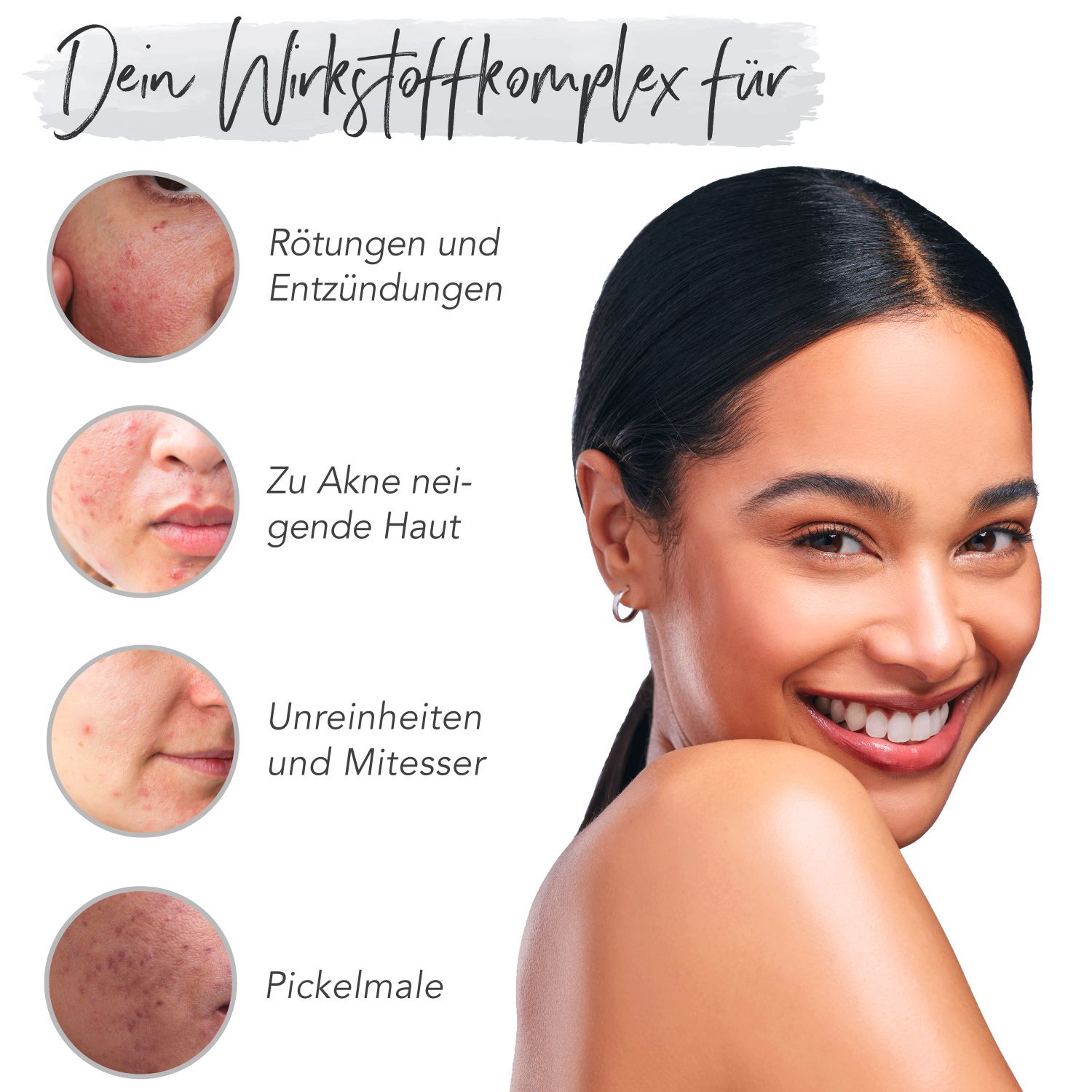 FACES OF FEY 10% Azelain Booster Ampullen