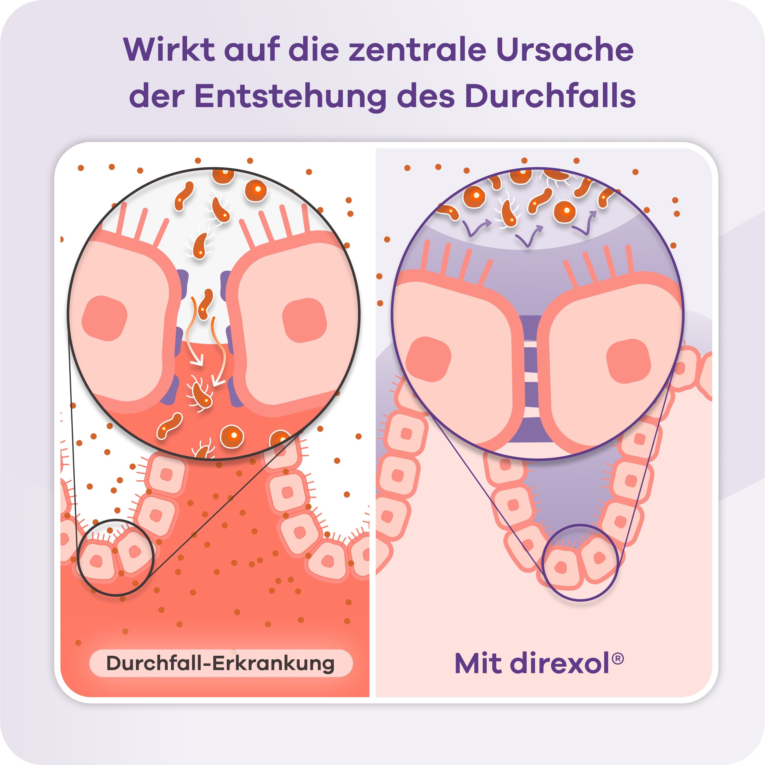 Vergleichsgrafik: Darm bei Durchfall-Erkrankung vs. mit Direxol. Zeigt Wirkung.