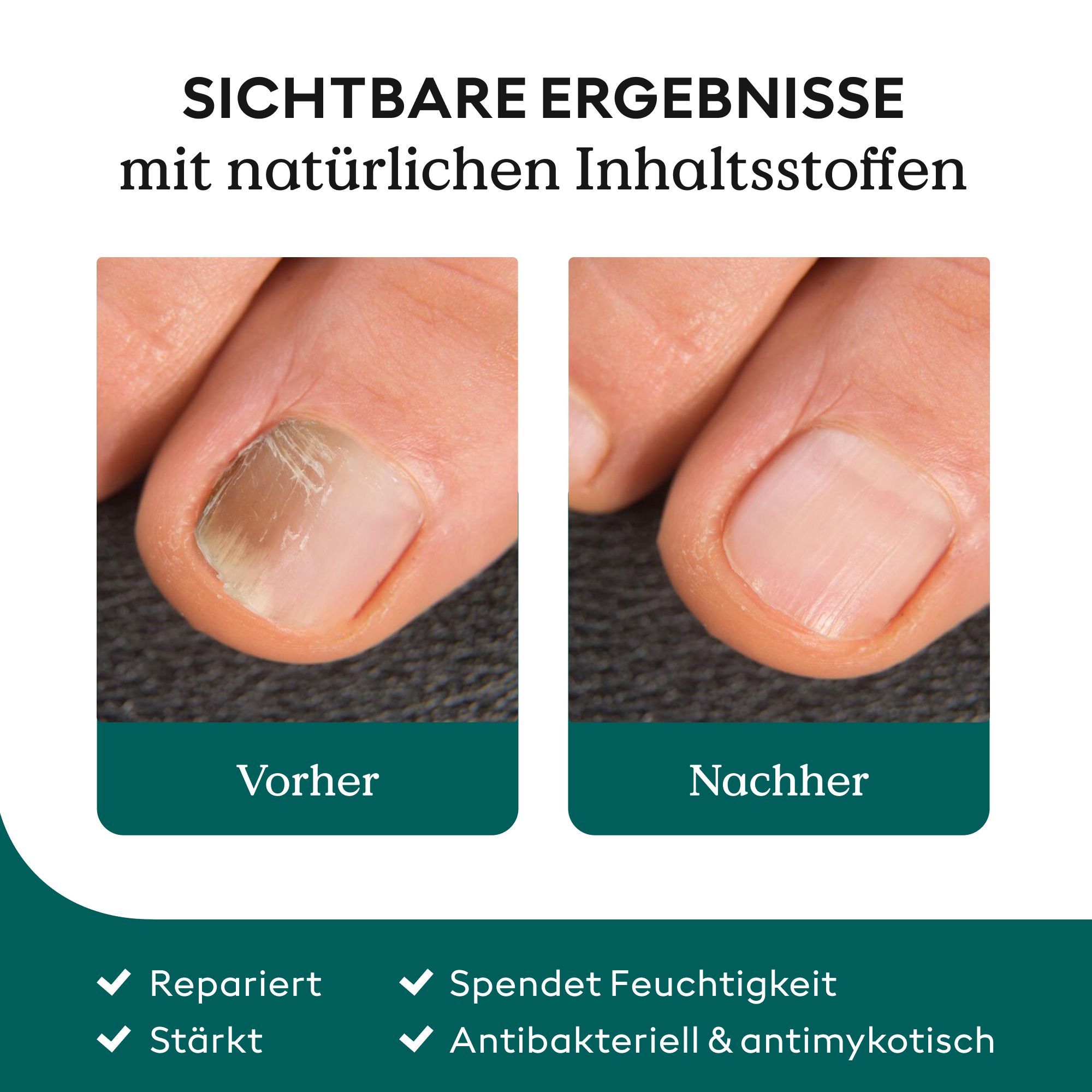 Health Routine Nail Care Pen / Pflege & Hygiene bei Nagelpilz 4 ml