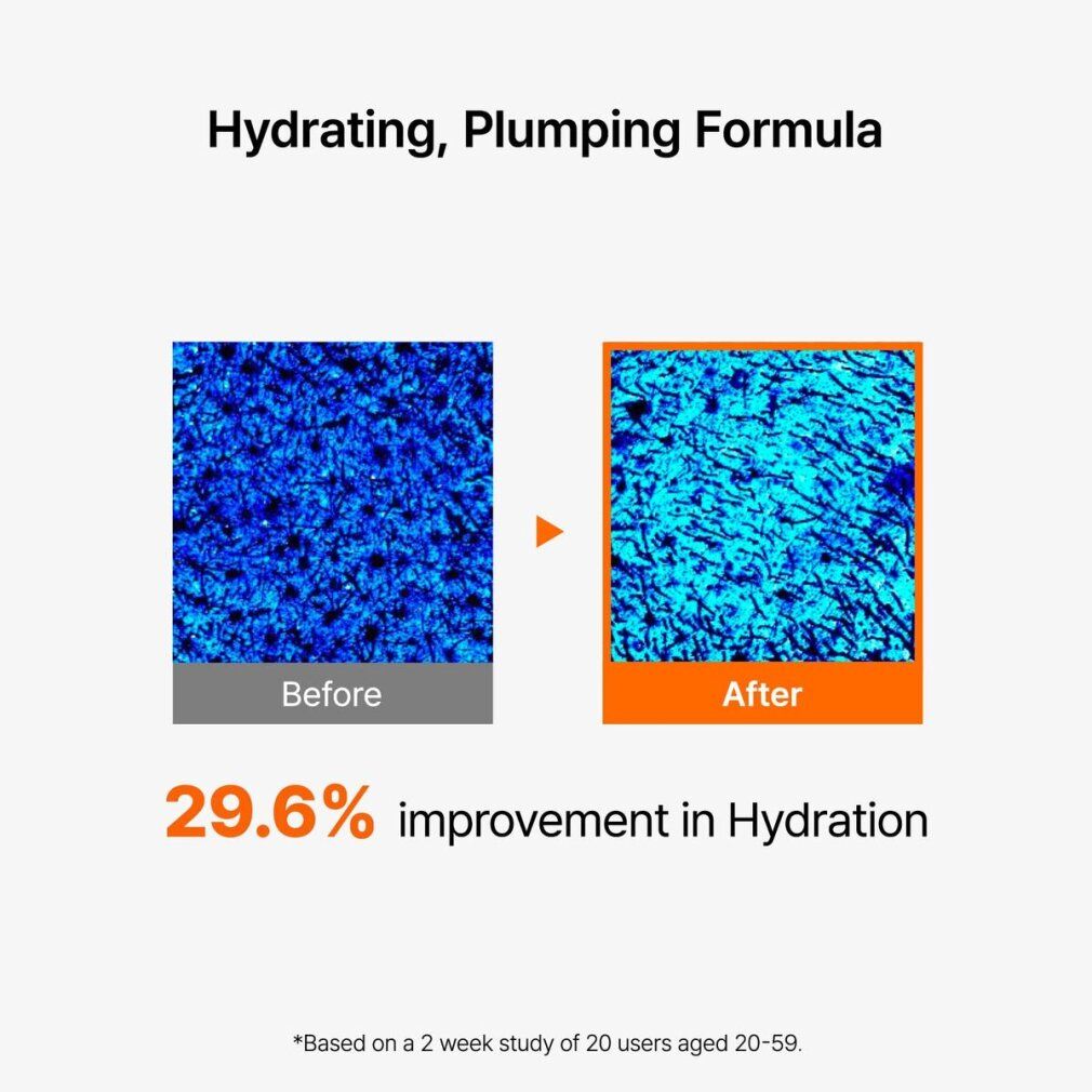 Vergleichsbild: Haut vor und nach Anwendung. 29,6% Verbesserung der Hydratation. Text: Hydratisierende, aufpolsternde Formel.